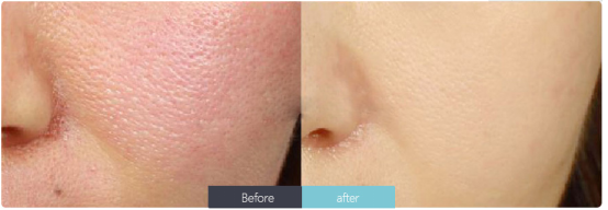 護(hù)膚小常識(shí)(1)-陳艷麗化妝品-董煥413